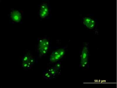 Immunocytochemistry/ Immunofluorescence: C1orf87 Antibody [H00127795-B01P]