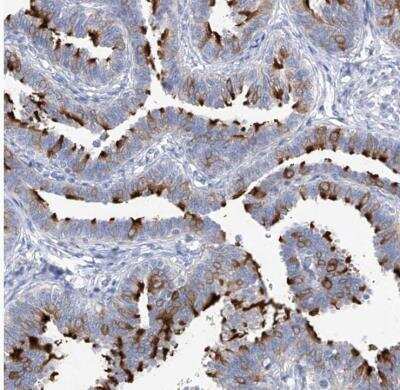 Immunohistochemistry-Paraffin: C1orf87 Antibody [NBP1-81101]