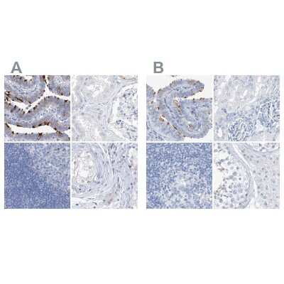 Immunohistochemistry-Paraffin: C1orf87 Antibody [NBP1-81101]