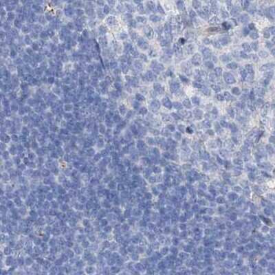 Immunohistochemistry-Paraffin: C1orf87 Antibody [NBP1-81101]