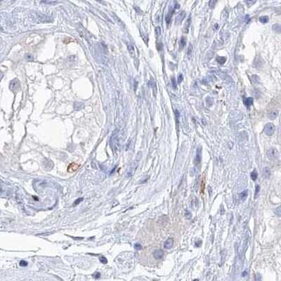 Immunohistochemistry-Paraffin: C1orf87 Antibody [NBP1-81101]