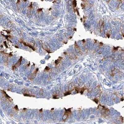 Immunohistochemistry-Paraffin: C1orf87 Antibody [NBP1-81101]