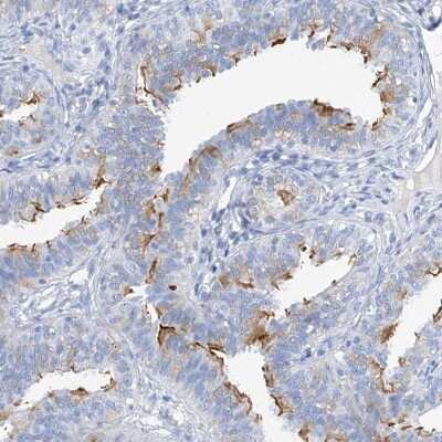 Immunohistochemistry-Paraffin: C1orf87 Antibody [NBP2-48611]