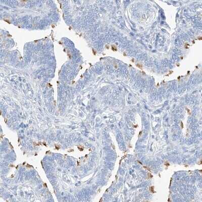 Immunohistochemistry-Paraffin: C1orf87 Antibody [NBP2-48611]