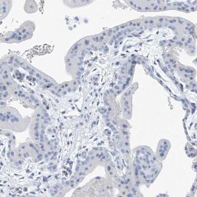 Immunohistochemistry-Paraffin: C1orf87 Antibody [NBP2-48611]