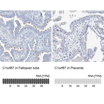 Immunohistochemistry-Paraffin: C1orf87 Antibody [NBP2-48611]