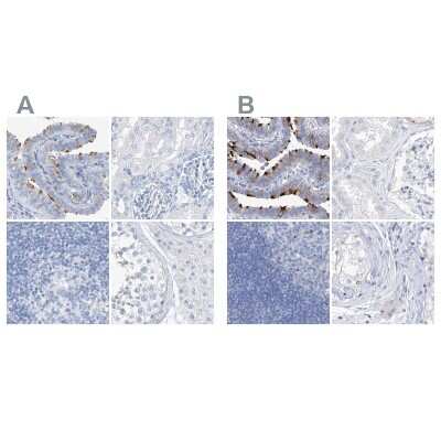 Immunohistochemistry-Paraffin: C1orf87 Antibody [NBP2-48611]