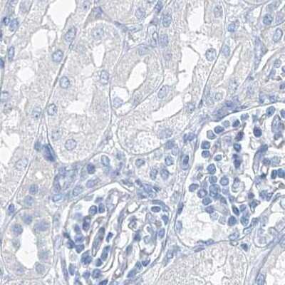Immunohistochemistry-Paraffin: C1orf87 Antibody [NBP2-48611]