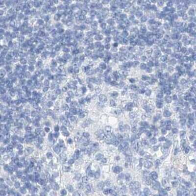 Immunohistochemistry-Paraffin: C1orf87 Antibody [NBP2-48611]