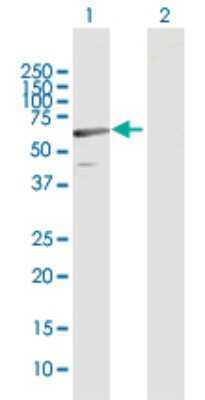 Western Blot: C1orf87 Antibody [H00127795-B01P]