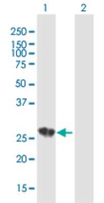 Western Blot: C1q Antibody [H00000712-B01P]