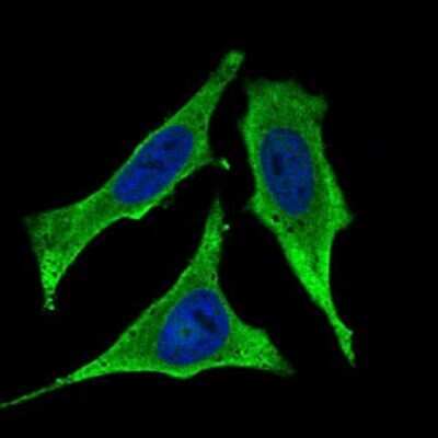 Immunocytochemistry/ Immunofluorescence: C1qR1/CD93 Antibody (1A10E10) - BSA Free [NBP2-37308]