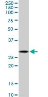 Western Blot: C1qTNF1/CTRP1 Antibody (4A10) [H00114897-M01]