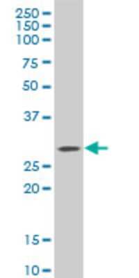Western Blot: C1qTNF1/CTRP1 Antibody (4A10) [H00114897-M01]