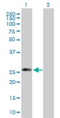 Western Blot: C1qTNF5/CTRP5 Antibody [H00114902-B01P]