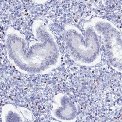 Immunohistochemistry-Paraffin: Nucleolar Protein 4 Like Antibody [NBP1-94114]