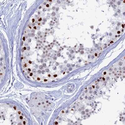 Immunohistochemistry-Paraffin: Nucleolar Protein 4 Like Antibody [NBP1-94114]