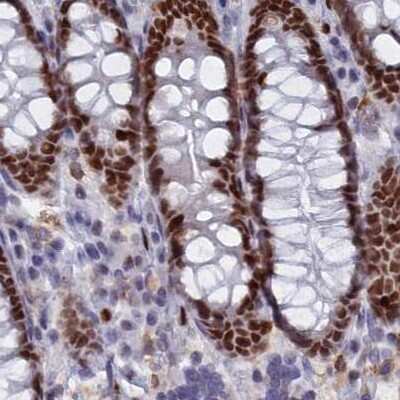 Immunohistochemistry-Paraffin: Nucleolar Protein 4 Like Antibody [NBP1-94114]