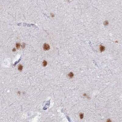 Immunohistochemistry-Paraffin: Nucleolar Protein 4 Like Antibody [NBP1-94114]