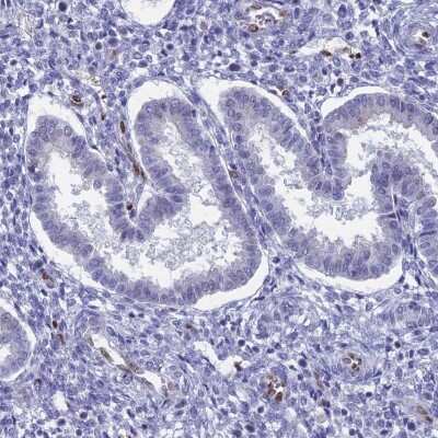 Immunohistochemistry-Paraffin: Nucleolar Protein 4 Like Antibody [NBP1-94115]