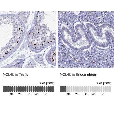 Immunohistochemistry-Paraffin: Nucleolar Protein 4 Like Antibody [NBP1-94115]