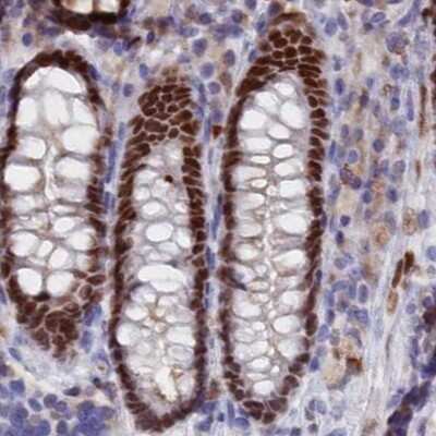 Immunohistochemistry-Paraffin: Nucleolar Protein 4 Like Antibody [NBP1-94115]