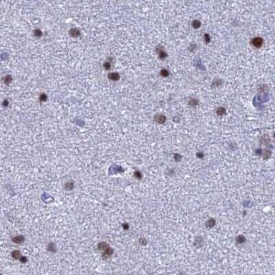 Immunohistochemistry-Paraffin: Nucleolar Protein 4 Like Antibody [NBP1-94115]
