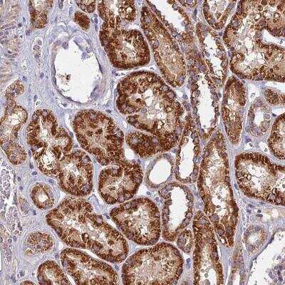 Immunohistochemistry-Paraffin: SPACA9 Antibody [NBP2-13364]