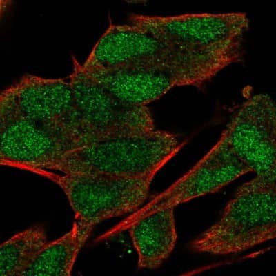 Immunocytochemistry/ Immunofluorescence: MROH8 Antibody [NBP2-34133]