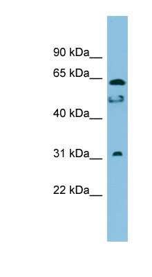 Western Blot: MROH8 Antibody [NBP1-57772]