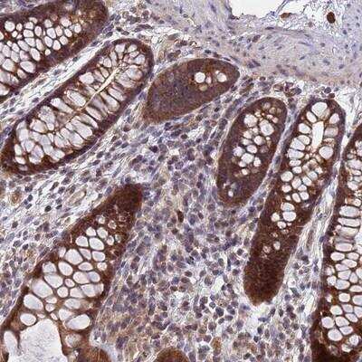 Immunohistochemistry: C20orf144 Antibody [NBP2-14398]