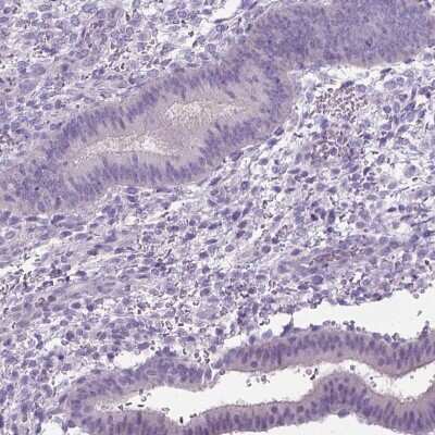 Immunohistochemistry-Paraffin: C20orf144 Antibody [NBP2-14398]