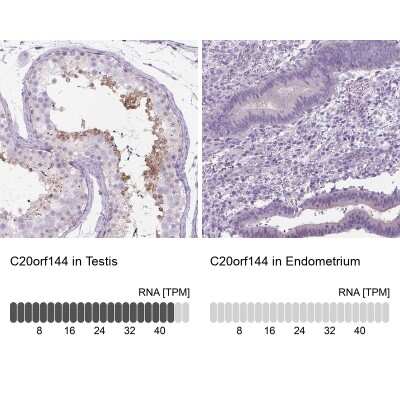 Immunohistochemistry-Paraffin: C20orf144 Antibody [NBP2-14398]