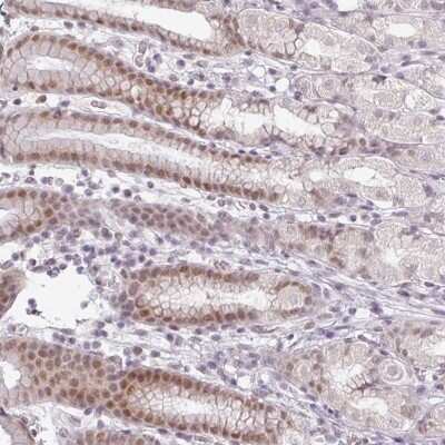 Immunohistochemistry-Paraffin: FAM65C Antibody [NBP2-30556]