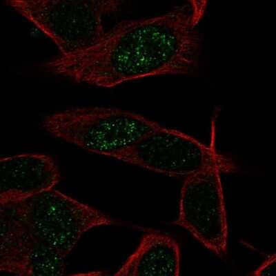 Immunocytochemistry/ Immunofluorescence: LKAAEAR1 Antibody [NBP2-49228]