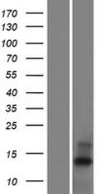 Western Blot: C20orf202 Overexpression Lysate [NBP2-09130]