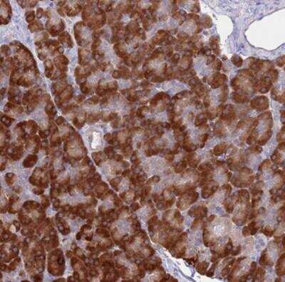 Immunohistochemistry: AP5S1 Antibody [NBP2-30509]