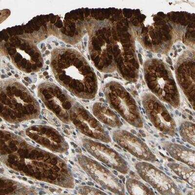 Immunohistochemistry-Paraffin: TMEM230 Antibody [NBP1-81671]