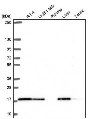Western Blot: TMEM230 Antibody [NBP2-55803]