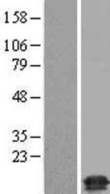 Western Blot: TMEM230 Overexpression Lysate [NBP2-09131]