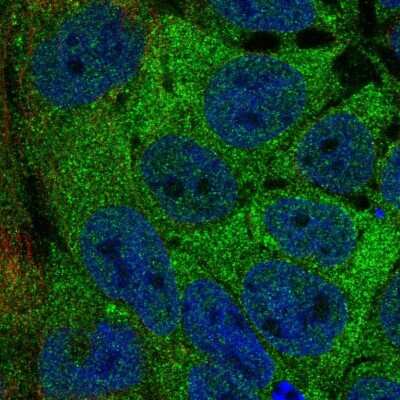 Immunocytochemistry/ Immunofluorescence: AAR2 Antibody [NBP2-30422]