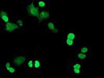 Immunocytochemistry/ Immunofluorescence: Replication Termination Factor 2 Antibody (OTI1E8) [NBP2-03584]