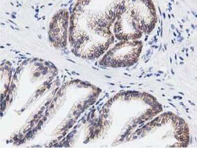 Immunohistochemistry-Paraffin: Replication Termination Factor 2 Antibody (OTI1E8) [NBP2-03584]