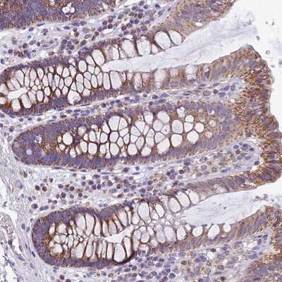 Immunohistochemistry-Paraffin: MGME1 Antibody [NBP1-91726]