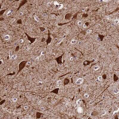 Immunohistochemistry-Paraffin: SLX4 Interacting Protein Antibody [NBP2-14567]