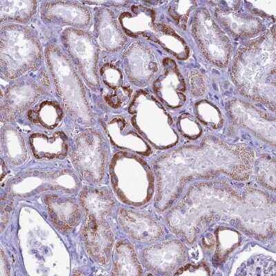 Immunohistochemistry: FAM243A Antibody [NBP2-47533]