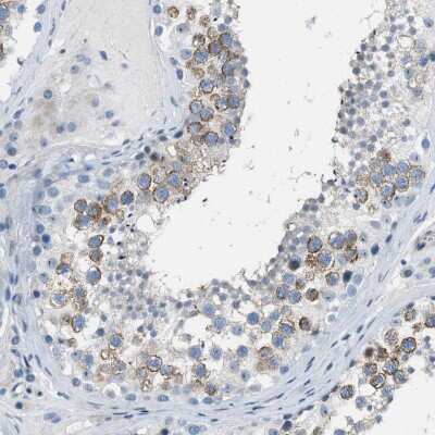 Immunohistochemistry-Paraffin: SPATC1L Antibody [NBP1-90939]