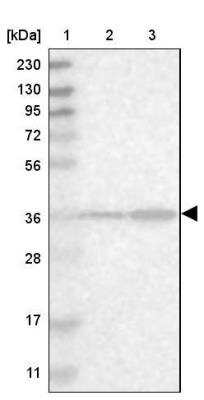Western Blot: SPATC1L Antibody [NBP1-90939]