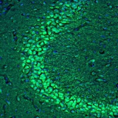 Immunohistochemistry: C21orf59 Antibody [NBP1-88275]
