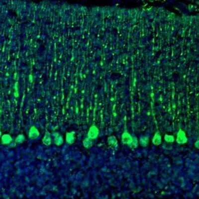 Immunohistochemistry: C21orf59 Antibody [NBP1-88275]